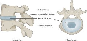 Intervertebral_Disk - Brisbane Back Pain Program | McGill Certified Practitioner | Online Coaching