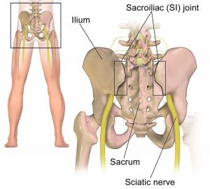 sciaticnerve - Brisbane Back Pain Program | McGill Certified Practitioner | Online Coaching