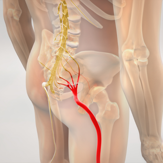 Sciatica3DRencer540 - Brisbane Back Pain Program | McGill Certified Practitioner | Online Coaching 3D render of the right side sciatic nerve