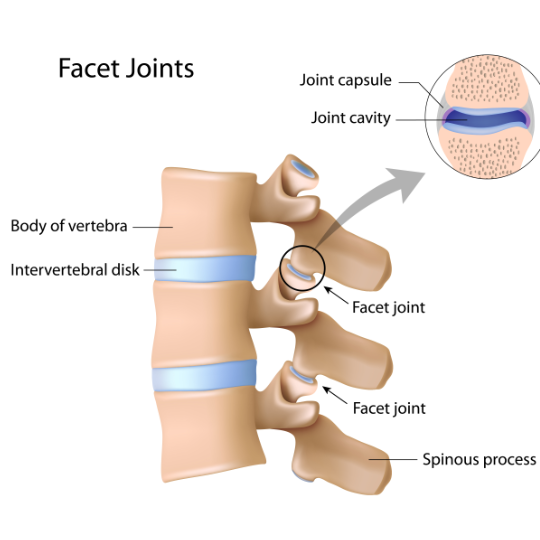 facetJoints540 - Brisbane Back Pain Program | McGill Certified Practitioner | Online Coaching Diagram of the lumbar spine showing the facet joints