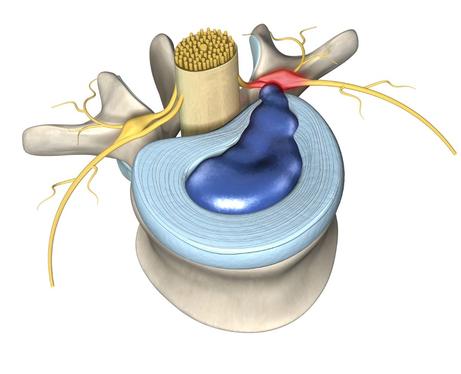 shutterstock_1681729564-900 - Brisbane Back Pain Program | McGill Certified Practitioner | Online Coaching
