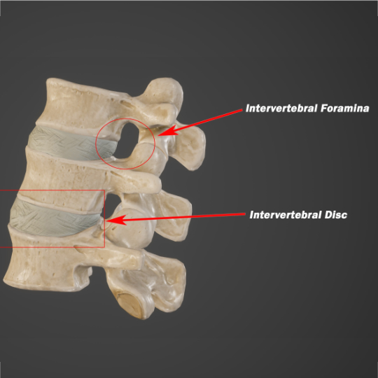 3dForamen540 - Brisbane Back Pain Program | McGill Certified Practitioner | Online Coaching 3 dimensional render of healthy lumbar vertebra with the foramina arrowed.