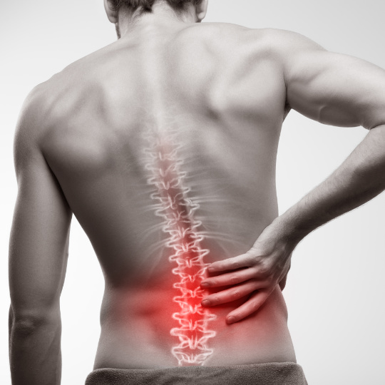 BackPain540 - Brisbane Back Pain Program | McGill Certified Practitioner | Online Coaching What causes lower back pain?