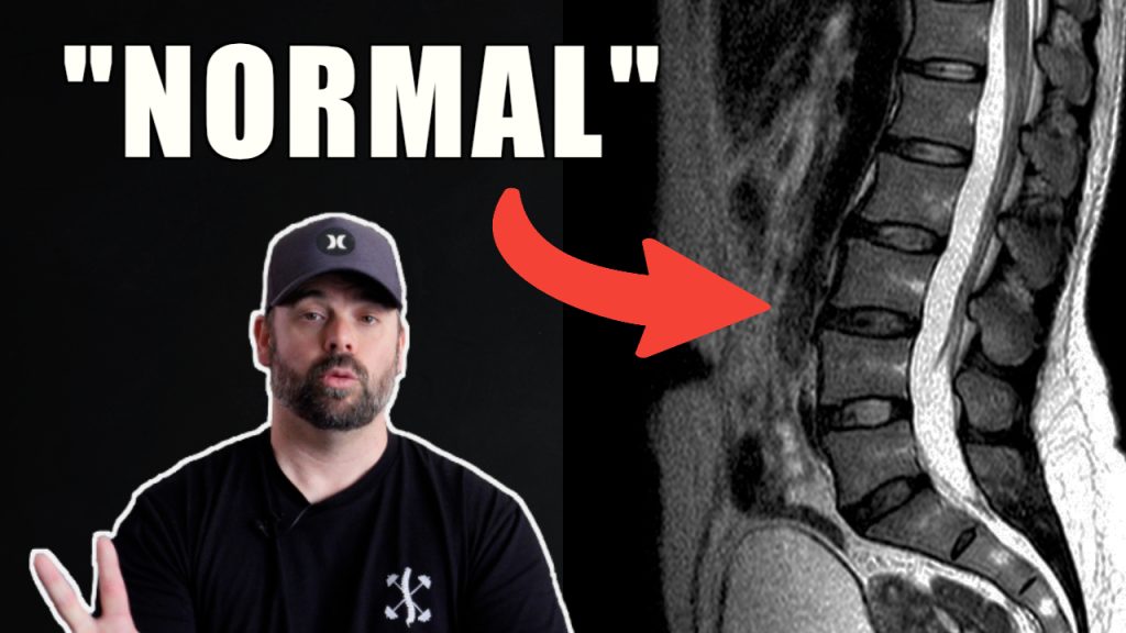 YoutubeThumbnailTemplate - Brisbane Back Pain Program | McGill Certified Practitioner | Online Coaching