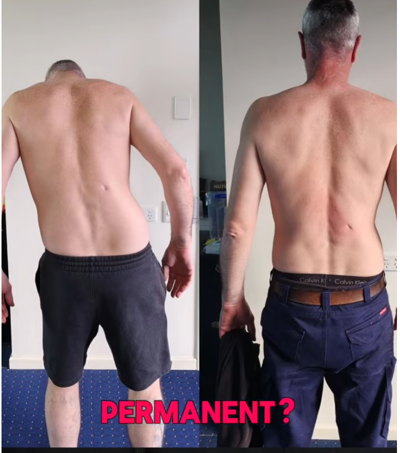 Before-and-after photo of a shirtless man showing a leaner back on the right, text 'PERMANENT?' at bottom.